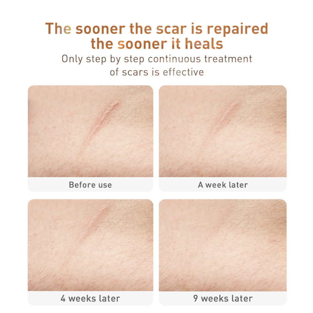 Herbal Repair Gel for Scar Removal by Cashymart, showing a tube of skin care gel on a neutral background.
