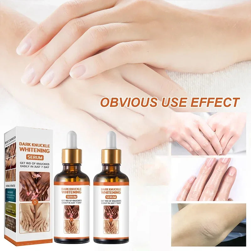 Cashymart skin whitening cream tube, smooth and creamy skincare product for brightening skin tone, close-up view.