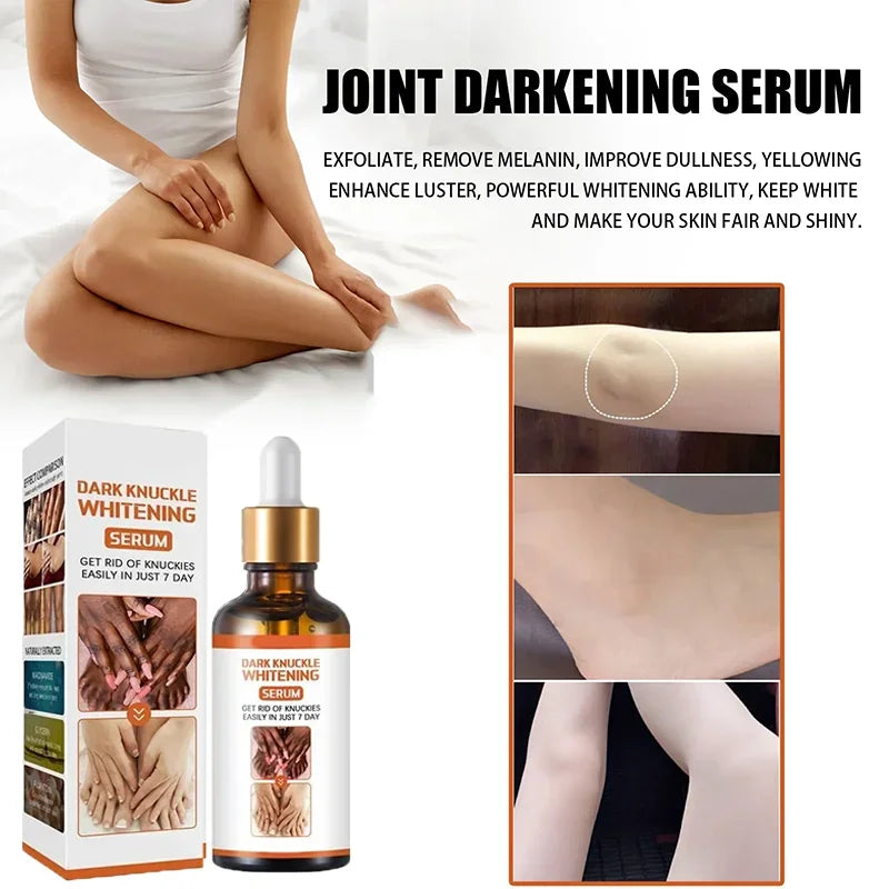 Cashymart skin whitening cream jar showing smooth, white cream inside for brightening skin and skincare benefits.