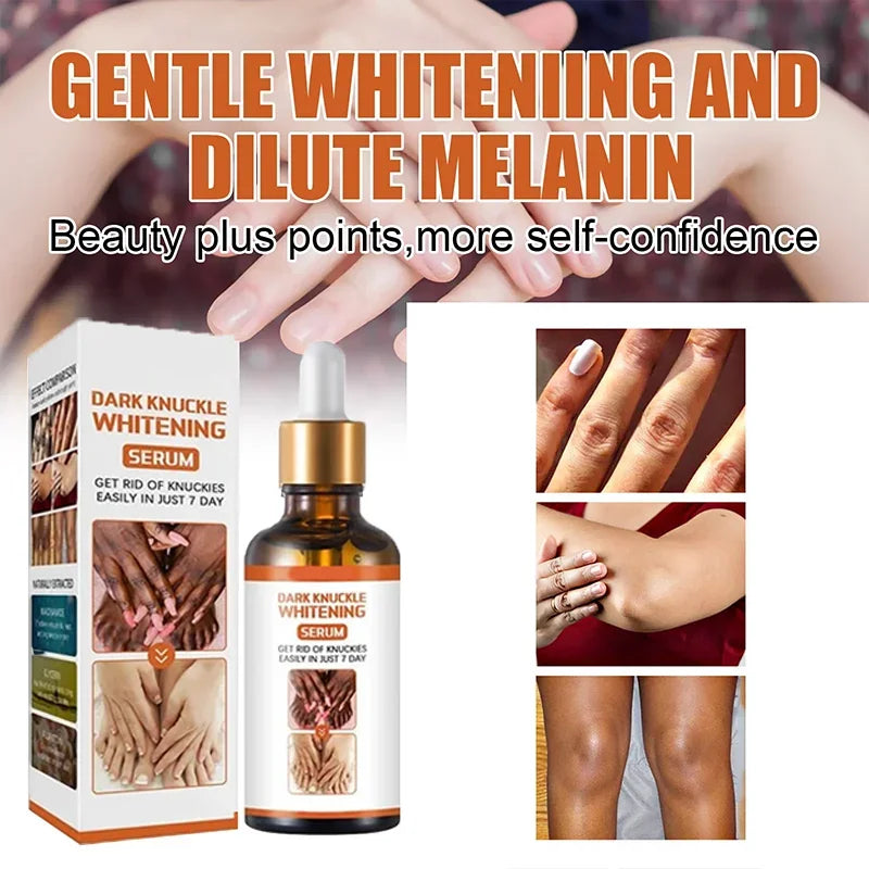 Cashymart skin whitening cream in a jar, smooth texture and light color, part of skincare routine for brightening skin.